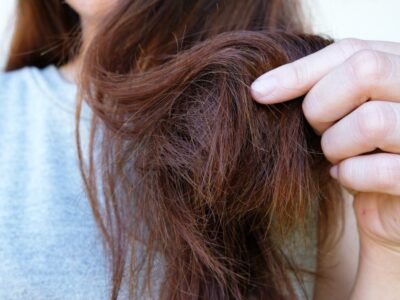شناخت آسیب های مو و راه حل رفع آسیب ها - ردیکا Redika
