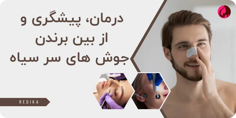 محصولات مراقبت پوست صورت
