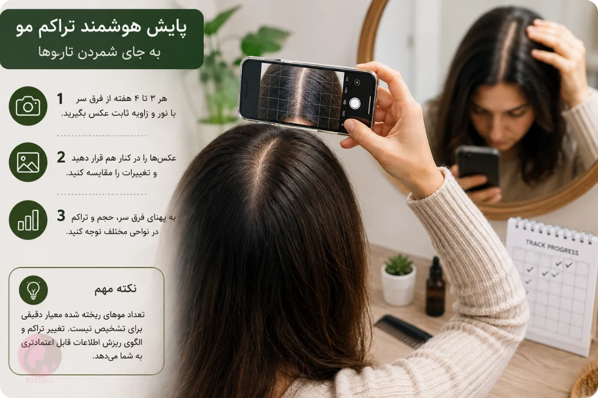 پایش تراکم مو با عکس‌برداری منظم از فرق سر به جای شمردن موهای ریخته‌شده